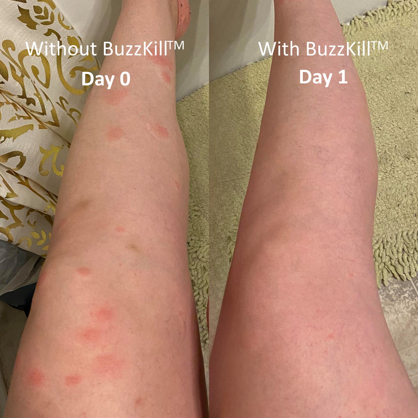 BuzzKill™ Non-Toxic Mosquito Repellant & Bite Healer