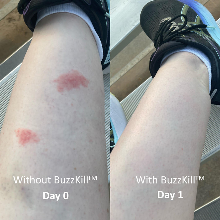 Buzzkill Insect BuzzKill™ Skincare-Grade Repellant & Hydrating Lotion – Buzz Kill
