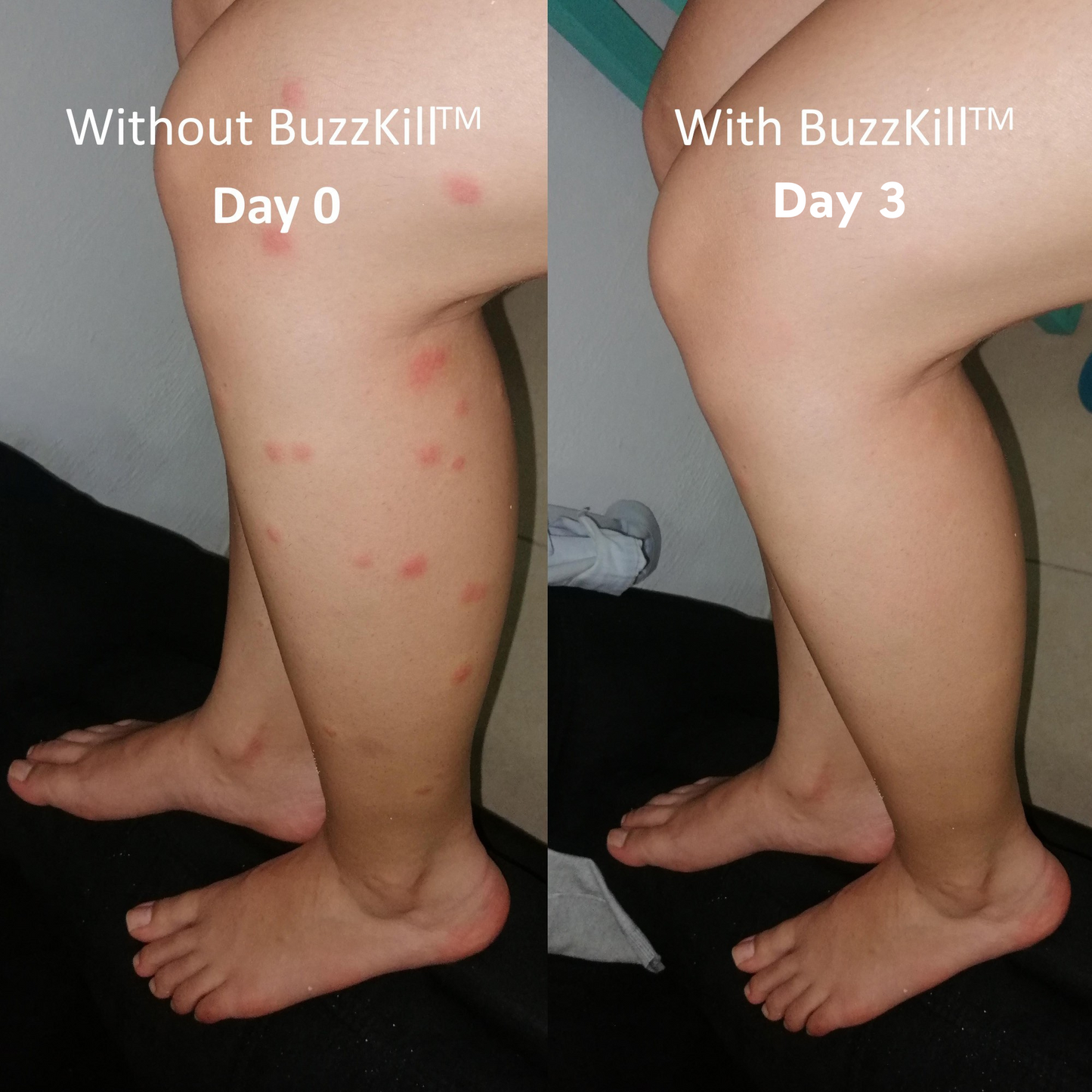 BuzzKill™ Non-Toxic Mosquito Repellant & Bite Healer