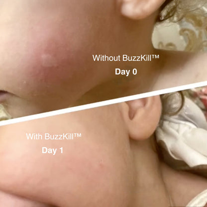 BuzzKill™ Non-Toxic Mosquito Repellant & Bite Healer
